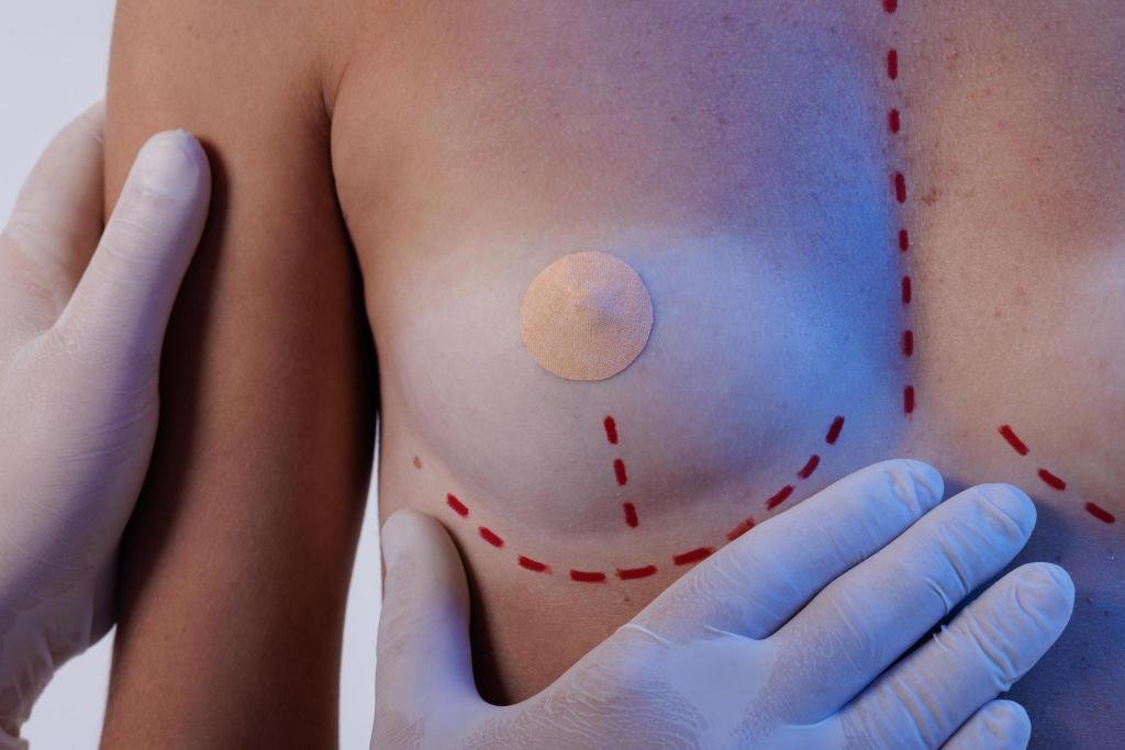cirugia-mastectomia-cirugia-de-mamas-cadiz
